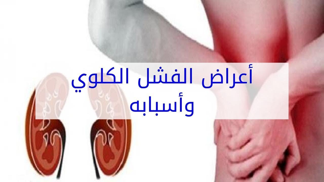 اعراض الفشل الكلوي المبكرة 2592 3