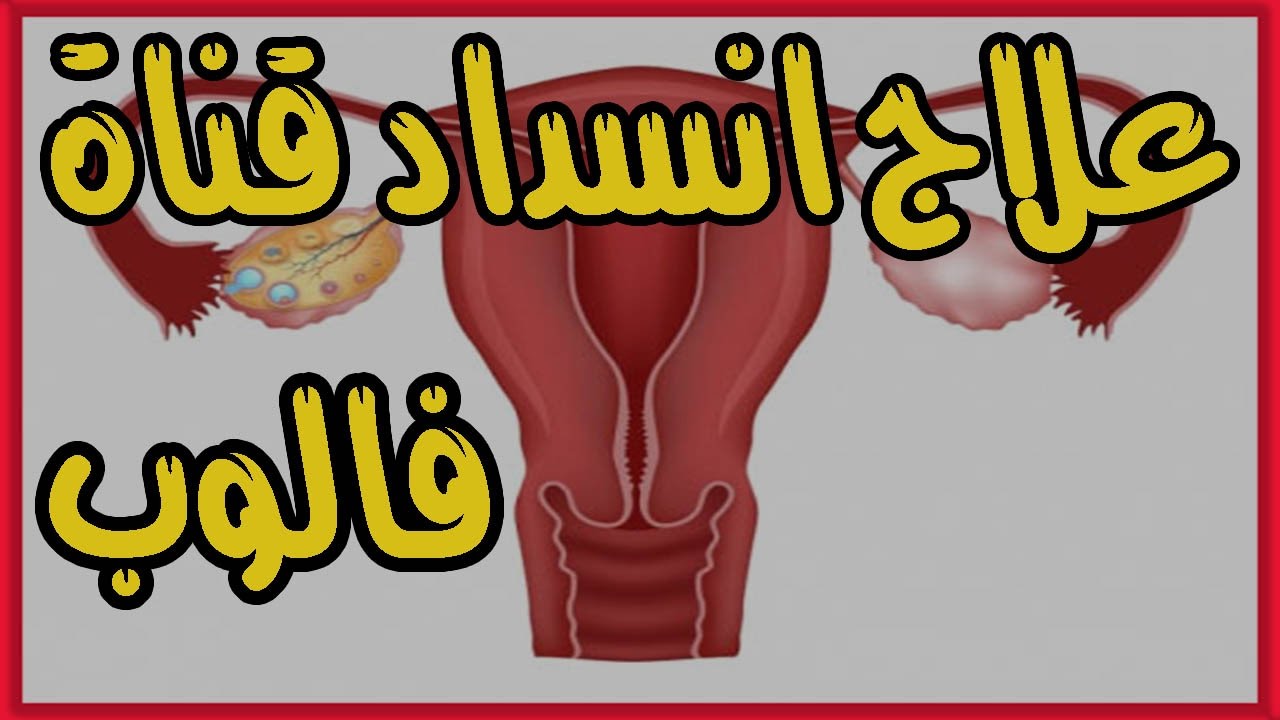 علاج انسداد قناة فالوب بالاعشاب - اشهر الاعشاب لعلاج انسداد قناه فالوب