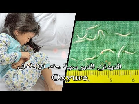 القضاء على الديدان عند الاطفال - احمي اطفالك من الاصابة بالدود في المعدة 2207 2