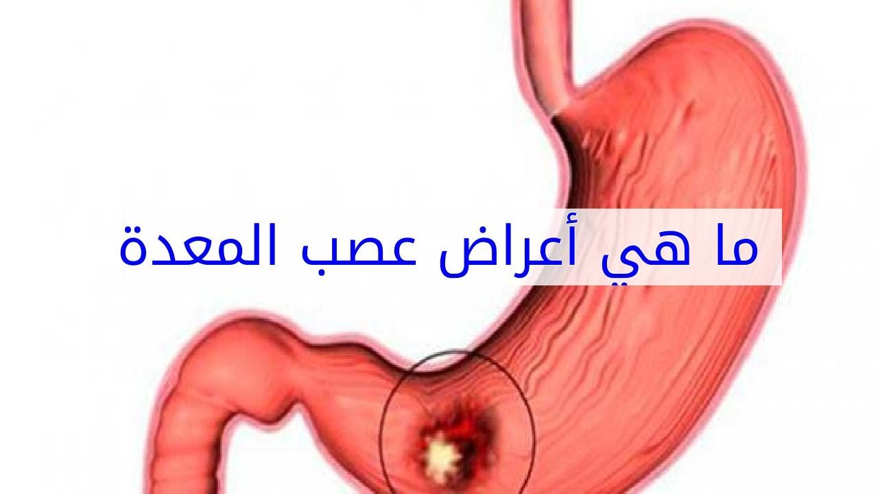 ماهي اعراض المعدة العصبية - عندك الم في معدتك تعالى اقولك بعض الاسباب 2046 3