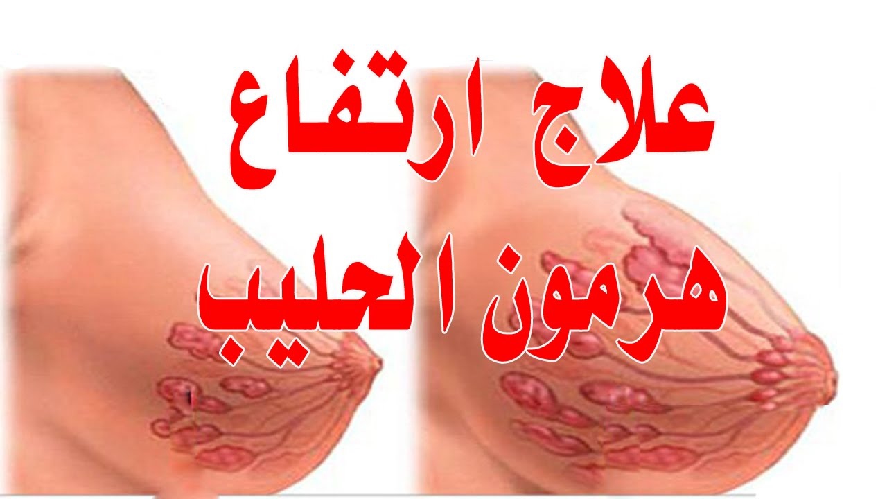 علاج ارتفاع هرمون الحليب - هل فيه علاج لزياده هرمو ن الحليب 491 2