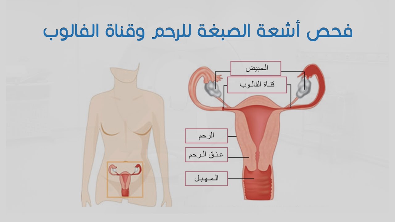 اشعة الصبغة للرحم - اشعات اضرارها كبيرة ويجب الاحتراس 1235 2