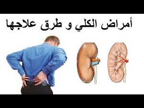 اعراض مرض الكلي تعرف على اعراض مرض الكلى 3438 1