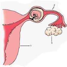 الحمل خارج الرحم , ماهوا الحمل خارج الرحم