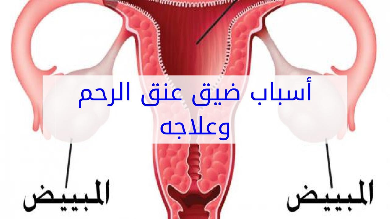 ضيق عنق الرحم , اسباب ضيق عنق الرحم