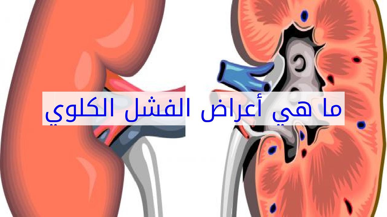 اعراض الفشل الكلوي المبكرة 2592 2